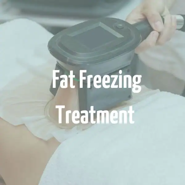 fat freezing treatment Crewe