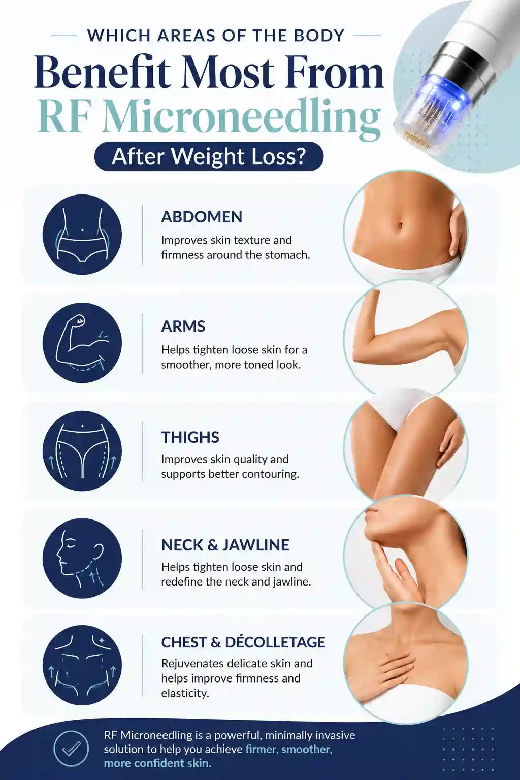 Which Areas of the Body Benefit Most From RF Microneedling After Weight Loss Crewe